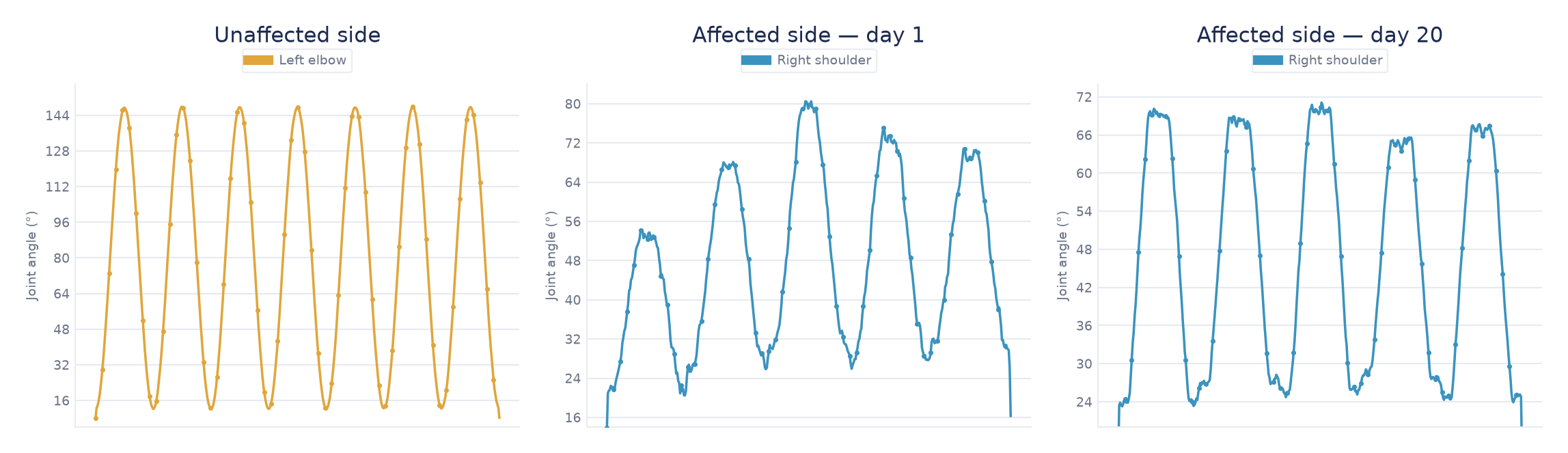Three joint-angle traces: repeated smooth high-amplitude movement on the unaffected left elbow, a reduced and irregular right shoulder trace on day 1, and a more consistent right shoulder trace by day 20